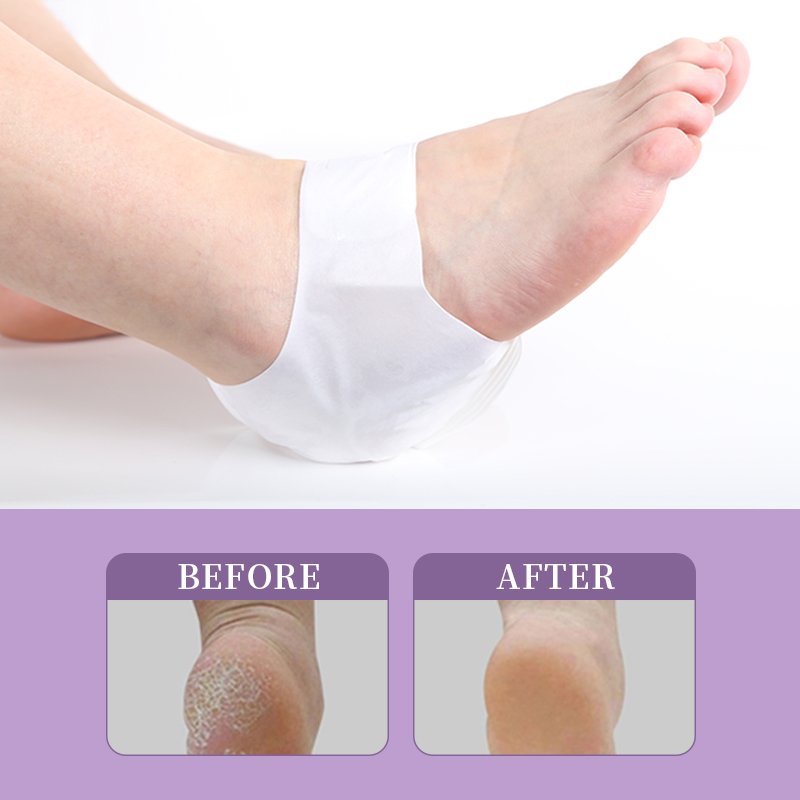 Lavender Peeling Feet Heel Mask - 4